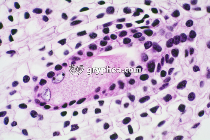 Lys - Sac embryonnaire dans ovaire x45 - gryphea.org